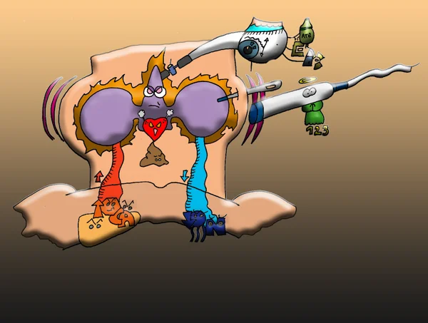 hyperthyroidie 1 — dessin MEDESSINE de Yoan Mboussou